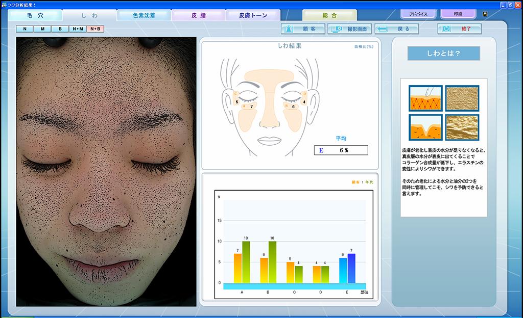 しわ（画面イメージ）
